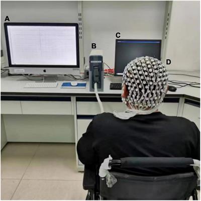 Motor Imagery-Related Changes of Neural Oscillation in Unilateral Lower Limb Amputation